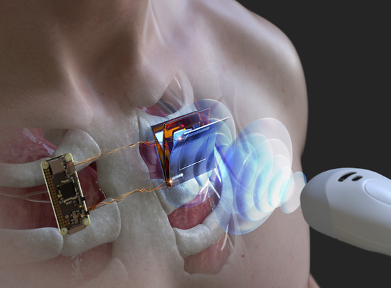 Charging Underwater and Body-Implanted Electronic Devices using Ultrasonic Waves