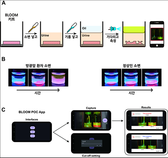 (A) 필름이 놓인 용기에 소변을 넣고, 기름을 넣고 기다렸다 기름층에서 발생하는 빛을 스마트폰 카메라로 촬영하면 진단이 되는 간단한 사용법 (B) 방광암 환자 소변과 정상인 소변을 넣은 용기에서의 시간에 따른 필름과 기름층에서의 신호 변화 (C) BLOOM 방광암 진단을 위한 스마트폰용 앱