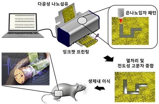 신경 장애, 생체에 이식한 신경전극으로 치료한다