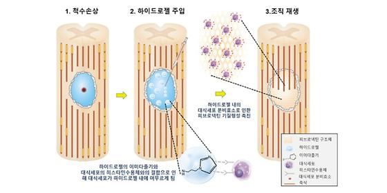 손상된 척수, 주사형 젤(gel)로 재생한다