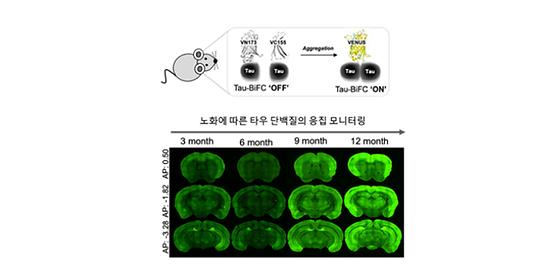 KIST, 신규 치매 플랫폼 개발 머릿 속 치매 원인물질을 초기 단계부터 관찰한다