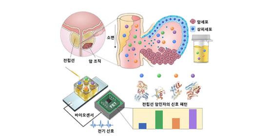 인공지능으로 소변검사를 통한 암 진단 정확도 높여